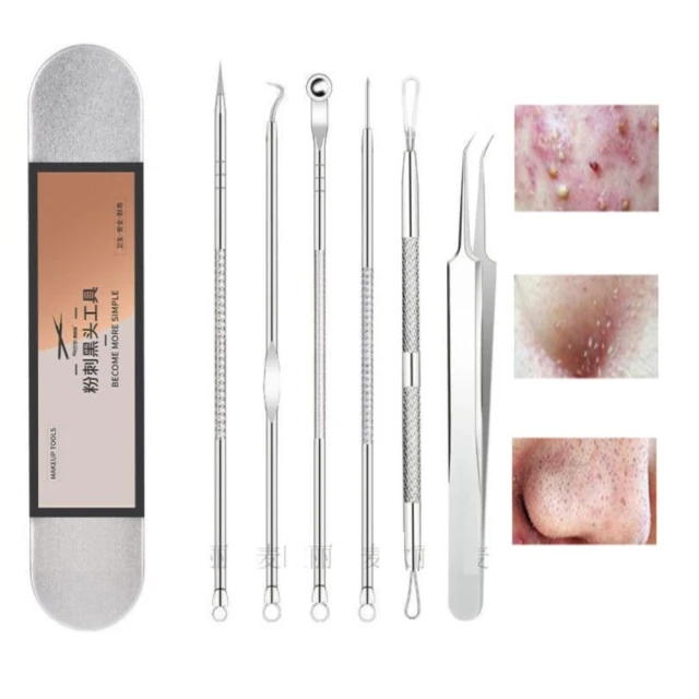 擠痘痘粉刺針4隻+尖嘴粉刺夾附鐵盒裝 歷史價格詳細信息