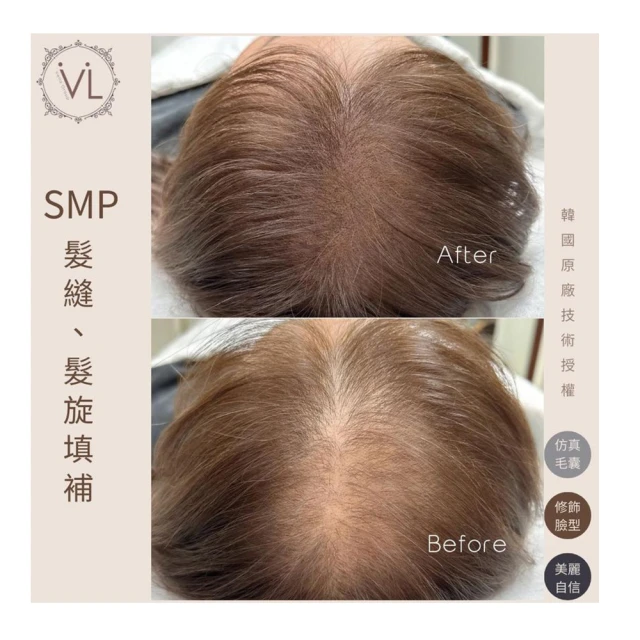 【薇拉時尚美學】日式美肌私密處-VIO全除毛(清爽潔淨！揮別悶熱不適黑森林〜) 歷史價格詳細信息