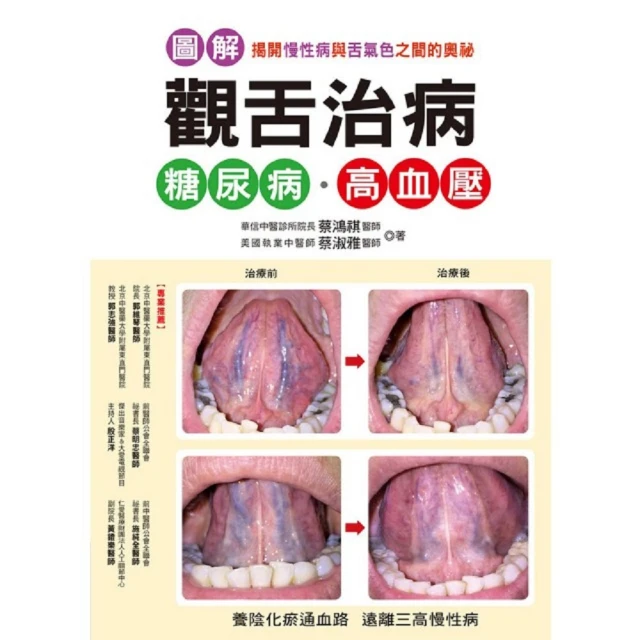高血壓、糖尿病、癲癇隨訪管理案例分析 黑龍江省衛生健康委員會著 9787571912635 【台灣高教簡體書】 歷史價格詳細信息