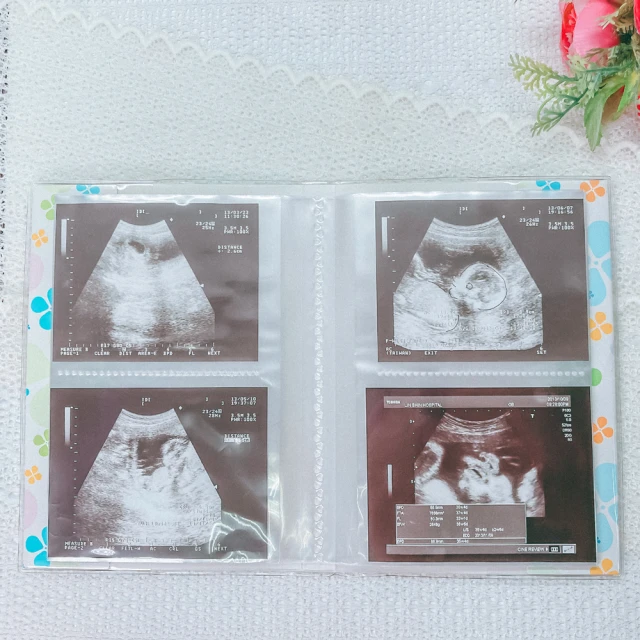 【Threeshape】超彈保暖!新一代光腿神器連腳踩腳連褲襪保暖褲襪(2色) 歷史價格詳細信息