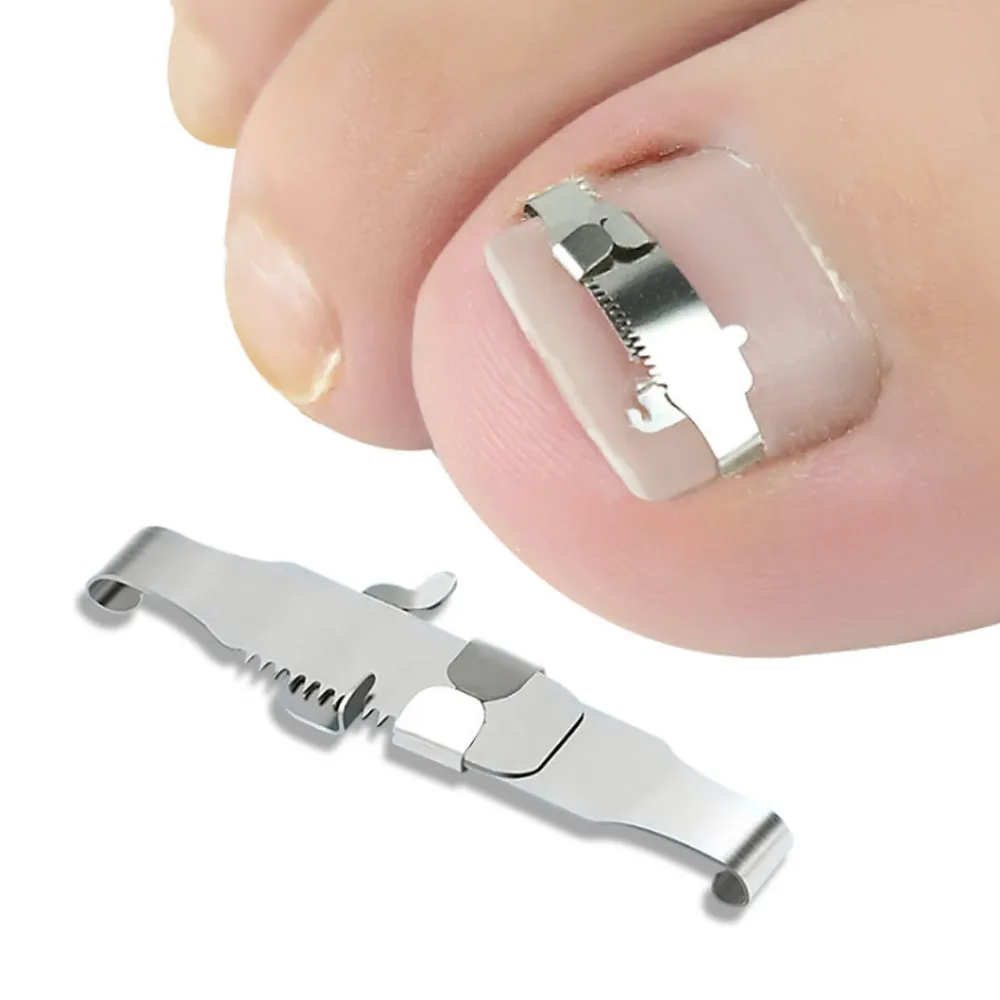 (杰恆)los1007雙趾護腳套拇指外翻矯正器男女腳趾外翻大腳骨矯正帶分趾 歷史價格詳細信息