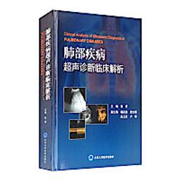 肺部造型煙灰缸抖音衕款創意個性網紅肺形狀煙灰缸戒煙自製diy的 XO59 歷史價格詳細信息