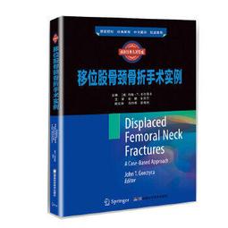 股骨近端截骨重建全髖關節置換術 尚希福 9787312028175 【台灣高教簡體書】 歷史價格詳細信息