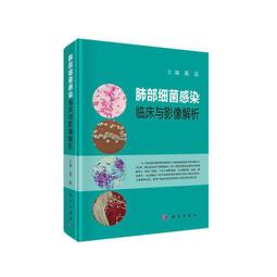 肺部造型煙灰缸抖音衕款創意個性網紅肺形狀煙灰缸戒煙自製diy的 XO59 歷史價格詳細信息