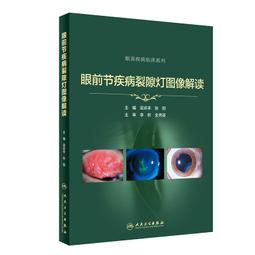裂隙燈透鏡  鍍增透膜  光學級標準  規格可任意制定大小 歷史價格詳細信息
