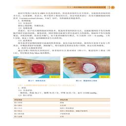 2【醫學2022】醫學精萃系列--支氣管與肺細胞病理學診斷圖譜 歷史價格詳細信息