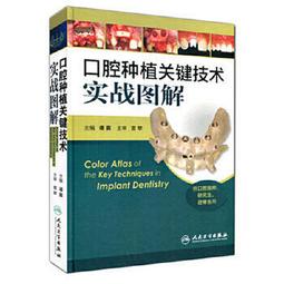口腔種植實用技術百問解析 梁立山 宮琳 楊瑟飛 9787122441683 【台灣高等教育出版社】 歷史價格詳細信息
