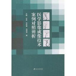 熱銷☆影像學讀片診斷圖譜骨肌分冊 - 丁建平、劉斯潤、龔向陽主編 2017-06-01 人民 歷史價格詳細信息