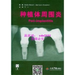 種植取骨鉆自體骨自研磨取骨粉彈簧取骨鉆牙科種植收集骨屑不流失 歷史價格詳細信息
