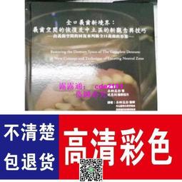 全新 新境界58mm UV鏡 適用於X-E1 XE2  X-A2 XT10 X-M1微單相機16-50鏡頭濾鏡 歷史價格詳細信息