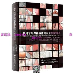 牙科用種植不銹鋼進口工具牙骨勺骨粉收集器刮勺充填器骨擠輸送器 歷史價格詳細信息