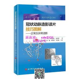 冠狀動脈造影讀片技巧圖解-正常及異常造影 (日)中川義久 (日)林秀隆 9787571419929 【台灣高教簡體書】 歷史價格詳細信息