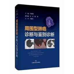 【吉華圖書】正版 - 肺癌 -  何建行  - 2021-07-07  - 中南大學出版社有限責任公司 -  84 歷史價格詳細信息