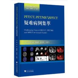 【SPECHT&SOHNE】【愛時】 飛行員系列 酒桶型錶殼 時尚太陽紋 機械錶 SP0011 歷史價格詳細信息