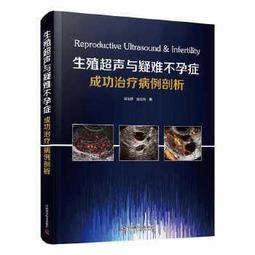 【吉華圖書】正版 - 擁抱抑鬱小孩：15個練習帶青少年走出抑鬱 資深心理諮詢師的15個親子互動練習，幫家長&ldquo;接住&rdquo;孩子的 歷史價格詳細信息
