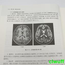 正版2【醫學2024】復雜初次全膝關節置換術 歷史價格詳細信息