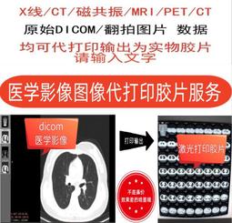 MRI 琉璃礦采 室內/戶外兩用助曬乳《寶貝曬嘿》 歷史價格詳細信息