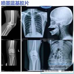 【好康】噴墨背膠透W明底片不乾膠透明列印底片獎牌胸標標牌列印底片 歷史價格詳細信息