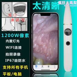 高清可視洗牙器智能美牙儀拋光沖牙器去結石聲潔牙器 歷史價格詳細信息