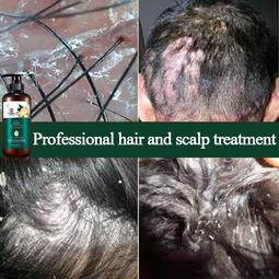 台灣現貨防脫洗髮水 植物防脫育發 深層修復 滋養護髮 強健髮根 增發密發 控油去屑洗髮露  露天市集  全台最大的網路購 歷史價格詳細信息