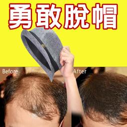 不流黑水【迪尼絲DINIS髮粉(纖維式假髮)25g4瓶】公司貨(附發票)免運費！ 歷史價格詳細信息