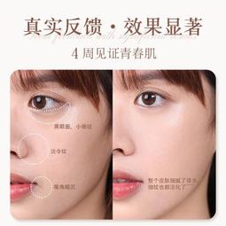 現貨 眼部按摩器滾珠彩光熱療眼部按摩器負離子去黑眼圈眼袋眼紋家用眼部導入儀器 歷史價格詳細信息