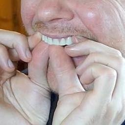 牙科正品上海偉榮微創牙挺 不銹鋼拔牙挺 星齒 口腔器械工具4件裝 歷史價格詳細信息