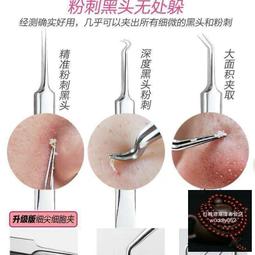 【滿300出貨】粉刺針祛痘神器暗瘡針痘痘針祛痘針細胞夾鑷子黑頭夾子擠痘痘工具 歷史價格詳細信息