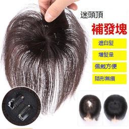 台灣現貨頭頂補發片 補發片女 仿真發縫女中分劉海假髮片 頭頂補發片 蓬鬆遮白髮補發塊 假髮片女 中分補發片 偏分補發片 歷史價格詳細信息