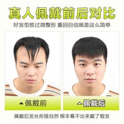 男士m型髮際線假髮貼劉海假髮片一片式男前額真髮絲全真人發貼片 歷史價格詳細信息