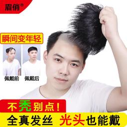 前額補發塊 心形補發塊透氣無痕頭頂遮白髮 增發量真人髮絲假髮片 歷史價格詳細信息
