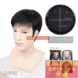限時下殺-男士補發片假發套頭頂補發前額禿頂補發墊接發翻蓋假發真發男發塊 歷史價格詳細信息