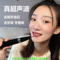 電動超聲波潔牙器 結石去除器 洗牙神器 全自動去牙垢菌斑 家用美牙儀 歷史價格詳細信息