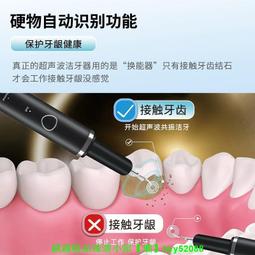 超聲波潔牙儀家用洗牙器去除牙結石電動除牙垢牙齒清潔污垢神器 歷史價格詳細信息