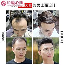 髮際線貼男假髮片男生m型短真髮貼補發瀏海假髮前額頭頂頭髮稀少 歷史價格詳細信息
