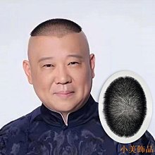 頭頂補髮塊 男士髮塊 真髮 隱形無痕禿頂 地中海前額補髮塊 假髮 歷史價格詳細信息