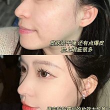 【Red Earth Rose】紅烈玫瑰浴廁清潔劑500ml 4入組 +長條縫隙刷2入(馬桶清潔 衛浴清潔 玻璃清潔) 歷史價格詳細信息